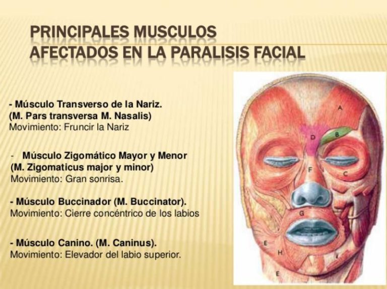 La parálisis fácial afecta de forma física y psicológica al paciente Salud y Medicina