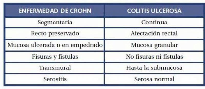 Diferencias Entre Colitis Ulcerativa Enfermedad De Cr - vrogue.co