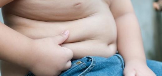 sobrepeso infantil